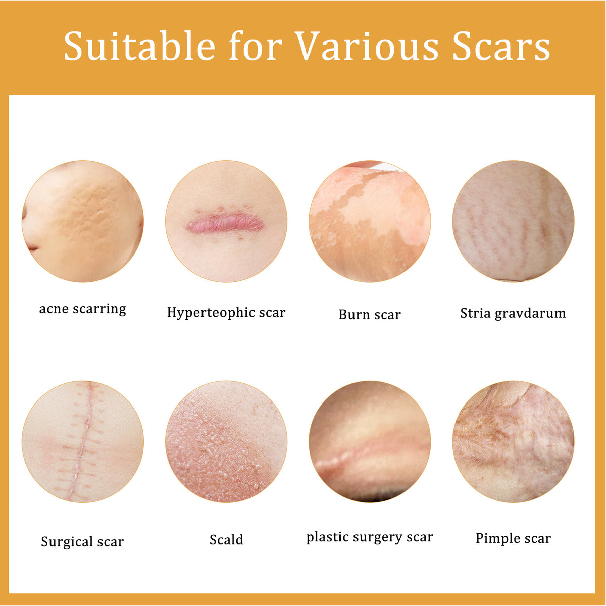 Desalting Skin Scar Cream, Skin Burn Scalding Surgical Scar Wound Repair Cream