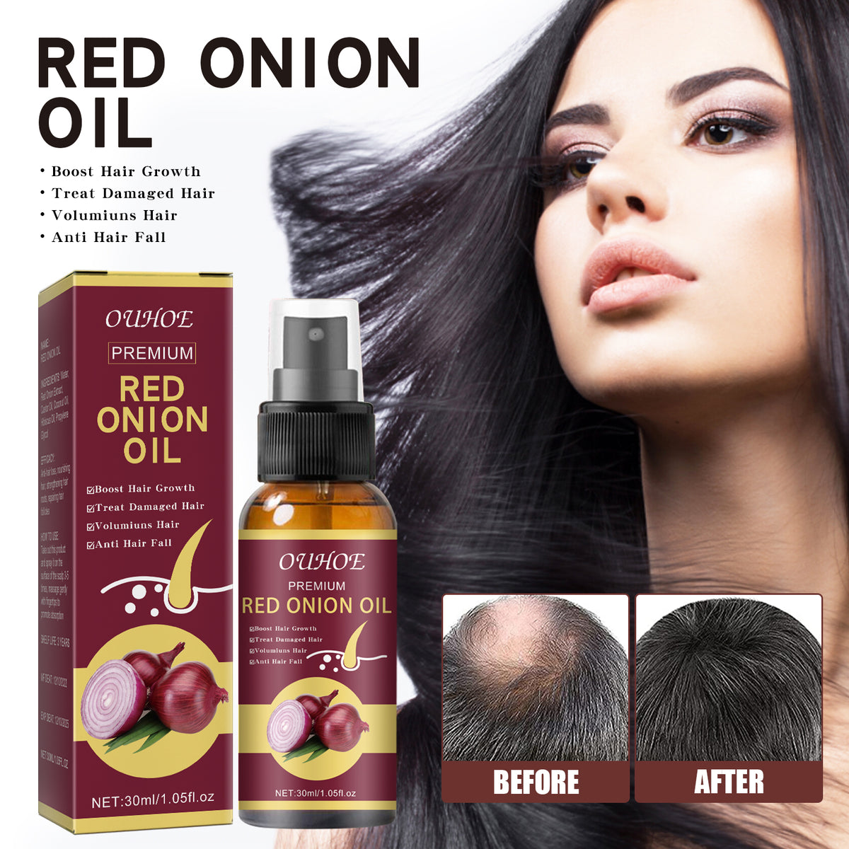 Onion Hair Growth Essential Oil, Strengthens And Hydrates Hair Growth Hair Dense Hair Care Spray