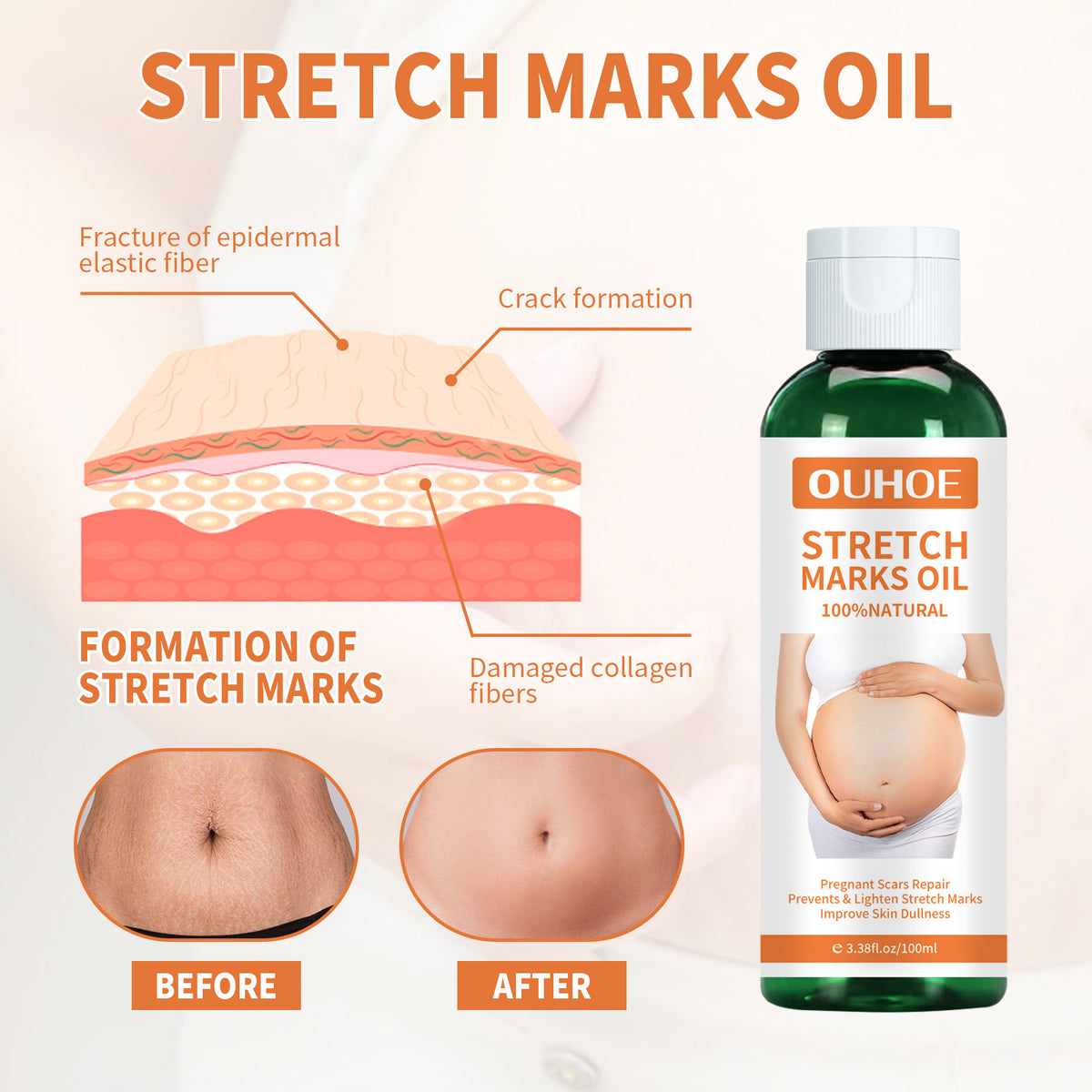 Pregnancy Massage Oil, Repair Pregnant Women Prenatal And Postpartum Stretch Mark Skin Care Massage Oil