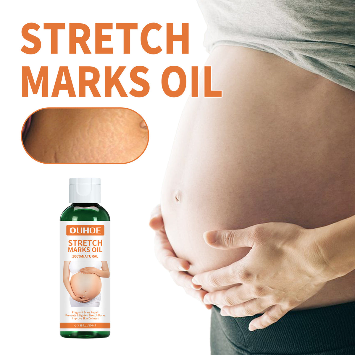 Pregnancy Massage Oil, Repair Pregnant Women Prenatal And Postpartum Stretch Mark Skin Care Massage Oil